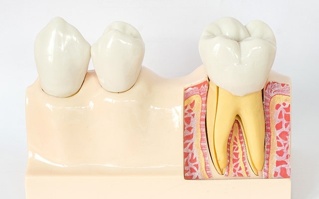 Основные показания для удаления зуба