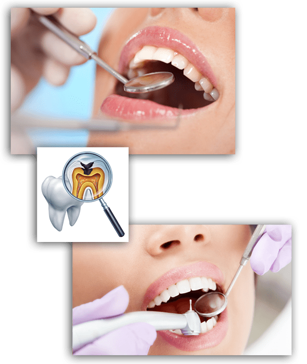 Терапевтическая стоматология - когда нужно идти к врачу?